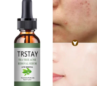 Acne Treatment Face Serum Tea Tree Oil Essence Moisturizing Shrink Pores Acne Facial Serum Korean Skin Care Products