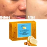 Turmeric & Kojic Acid Brightening Soap Turmeric Soap Bath Ginger Lemon Cold Soap Acid Soap Hand-made Soapkojic Soap F1j1