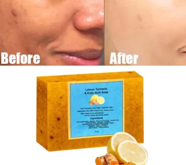 Turmeric & Kojic Acid Brightening Soap Turmeric Soap Bath Ginger Lemon Cold Soap Acid Soap Hand-made Soapkojic Soap F1j1
